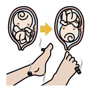 知って得する 鍼灸で逆子の治療が可能 名古屋で鍼灸に関する知識を発信する にこにこコラム