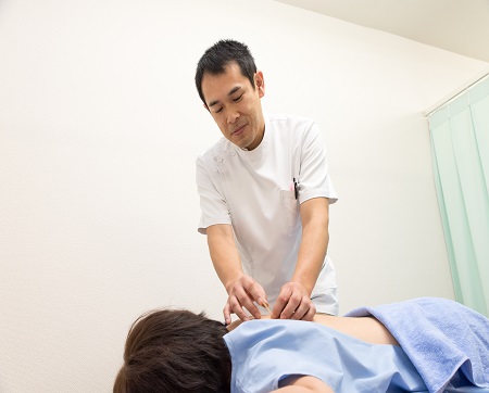 刺鍼中